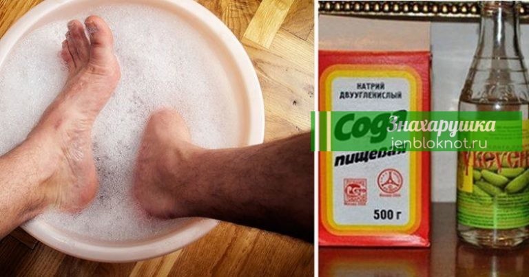 Смесь, от которой исчезает грибок на ногах и руках