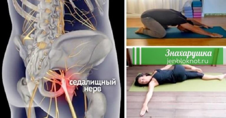 8 упражнений и поз из йоги, с которыми вы навсегда забудете о радикулите и болях в спине