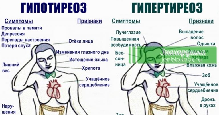 93% людей с проблемами со щитовидкой не знают об этом. Вот вся нужная информация