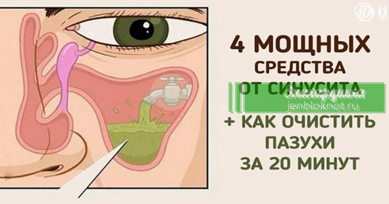 Если вас замучил насморк, попробуйте эти 4 мощных средства