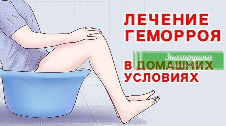 Как вылечить геморрой народными средствами
