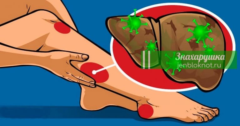 9 признаков того, что ваша печень переполнена токсинами