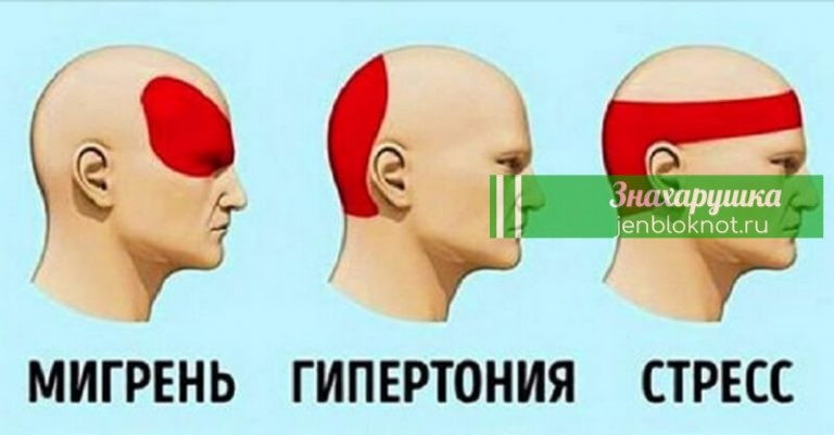 За 5 минут избавиться от головной боли без таблеток. Это просто