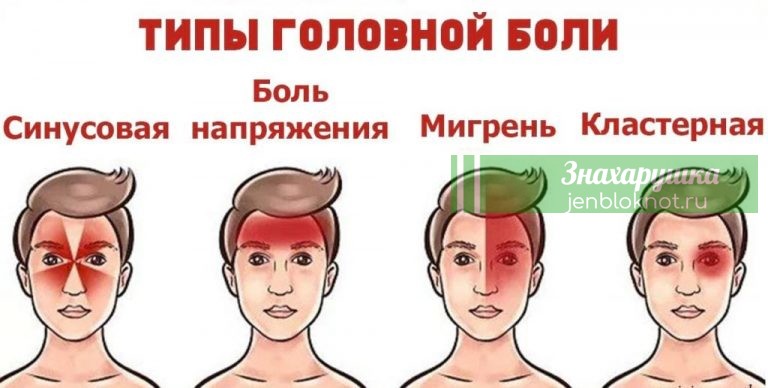 4 вида головной боли. Вот как правильно избавиться от каждой из них