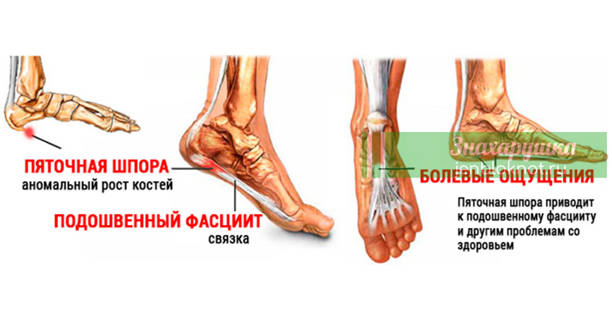 ÐÑÑÐºÐ° ÑÐ¿Ð¾ÑÐ°