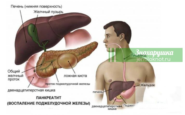 Три важных народных средства для лечения поджелудочной железы
