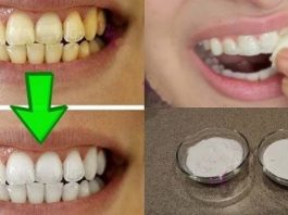 Отбеливание желтых зубов менее чем за 2 минуты