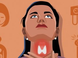 20 признаков того, что ваша щитовидка работает либо слабо, либо чересчур сильно