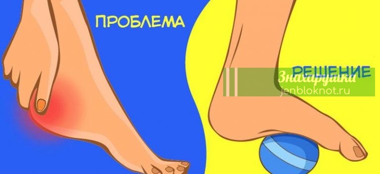 Простые упражнения, которые помогут вам избавиться от болей в области тазобедренного сустава, колена или стопы
