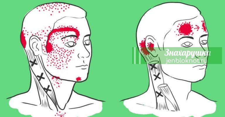Нехватка этих продуктов вызывает головную боль. Жаль, что не знала об этом раньше