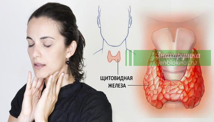 Врачи никогда не скажут Вам это: щитовидную железу можно вылечить с помощью всего одного ингредиента