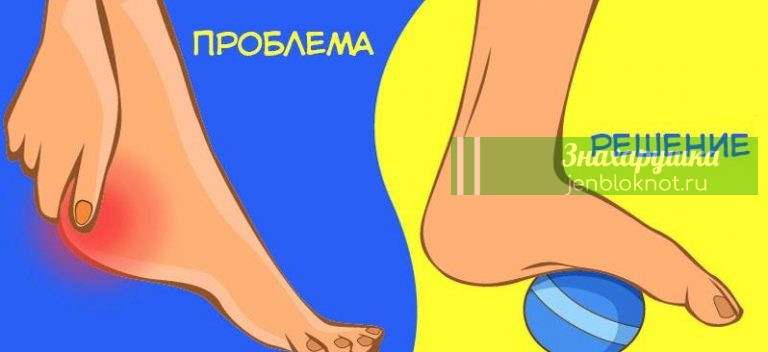 Простые упражнения, которые помогут вам избавиться от болей в области тазобедренного сустава, колена или стопы