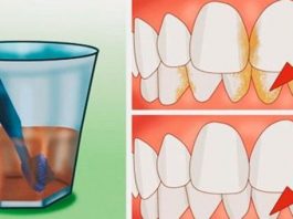 Вот лучшее средство для удаления зубного камня, воспаления десен и отбеливания зубов