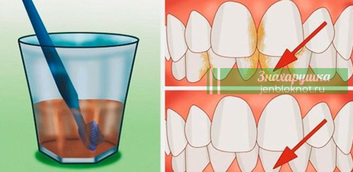 Вот лучшее средство для удаления зубного камня, воспаления десен и отбеливания  зубов — Дни.Жизнь.Суть