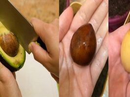 Всего 1 косточка авокадо и ваши почки свободны от камней