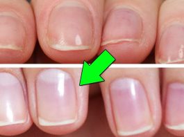 Как быстро отрастить ногти, которые никогда не сломаются: поможет простое средство из 4 компонентов