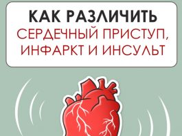 Как различить сердечный приступ, инфаркт и инсульт
