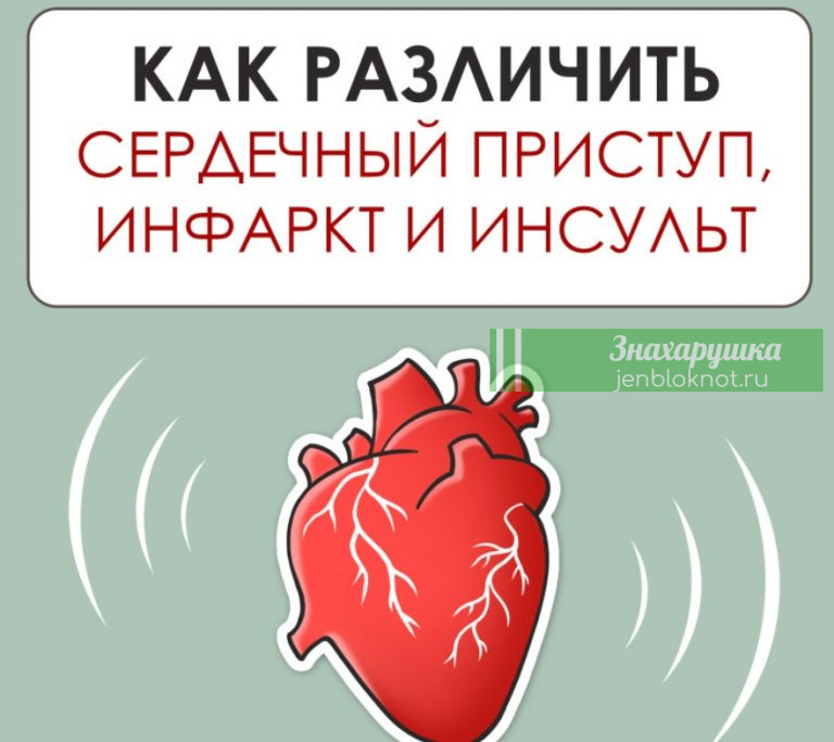 Как различить сердечный приступ, инфаркт и инсульт