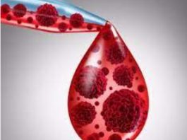Как разжижить густую кровь: 7 продуктов, которые кардиологи рекомендуют употреблять