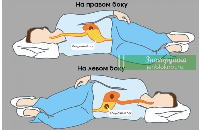 Помните: Всегда спите на левом боку. Вот почему