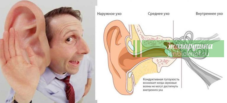 7 рецептов, как вернуть потерянный слух. Лечится даже старческая тугоухость и сильное ухудшение слуха