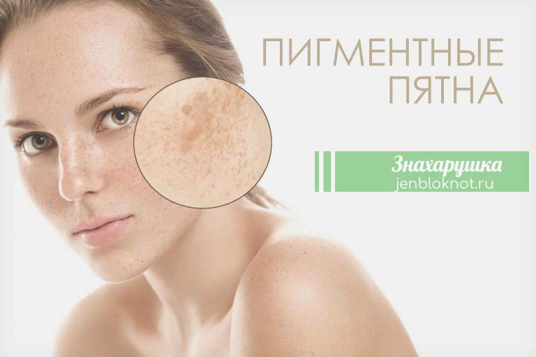Я врач — дерматолог. И я знаю только 1 способ избавиться от коричневых пятен на коже