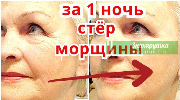 Избавляемся от морщин за ночь