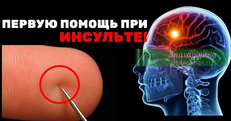 Первая помощь при инсульте: Вашу жизнь спасет всего лишь одна игла