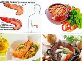 Питание при хроническом панкреатите и холецистите в период обострения