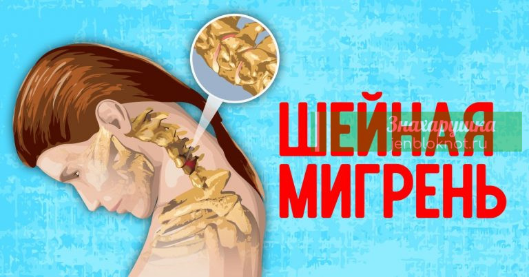 ШЕЙНАЯ МИГРЕНЬ: не старайтесь побороть таблетками