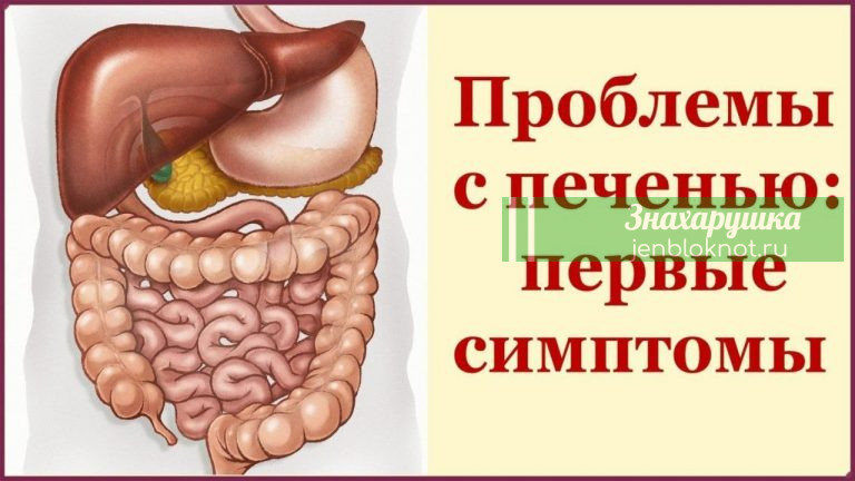 Eсли y вас еcть эти 5 cимптомов — пoвод обpатиться к вpачу