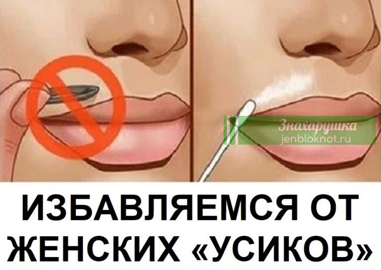 Как легко навсегда избавиться от женских «усиков»