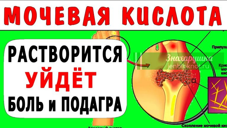 Как удалить мочевую кислоту из суставов. Удивительный рецепт