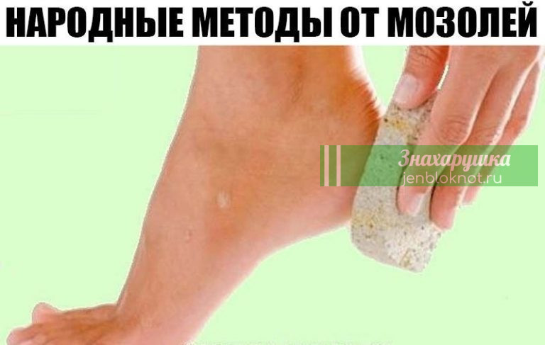НАРОДНЫЕ МЕТОДЫ ОТ МОЗОЛЕЙ