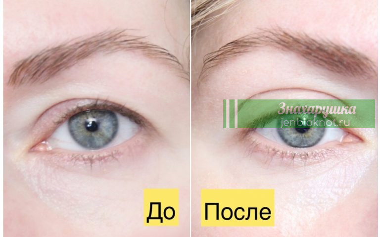 Убираем нависшие веки. Мощный рецепт проверенный временем