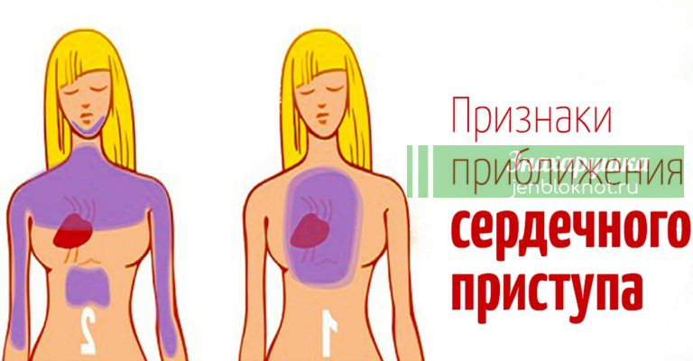 ЗА МЕСЯЦ ДО СЕРДЕЧНОГО ПРИСТУПА ВАШЕ ТЕЛО ПРЕДУПРЕДИТ ВАС ЭТИМИ 9 СИГНАЛАМИ