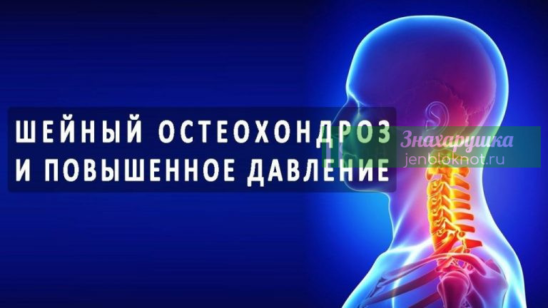 Неразлучная парочка. Шейный остеохондроз и высокое давление